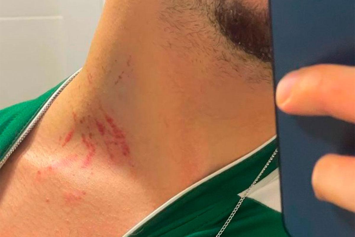 Briga de atletas de esgrima leva à intervenção policial no campeonato.