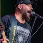 Baixista do Ultraje a Rigor recebe prótese no crânio após ferimento.