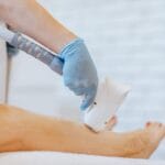 Mulher indenizada após queimaduras na virilha durante depilação a laser.