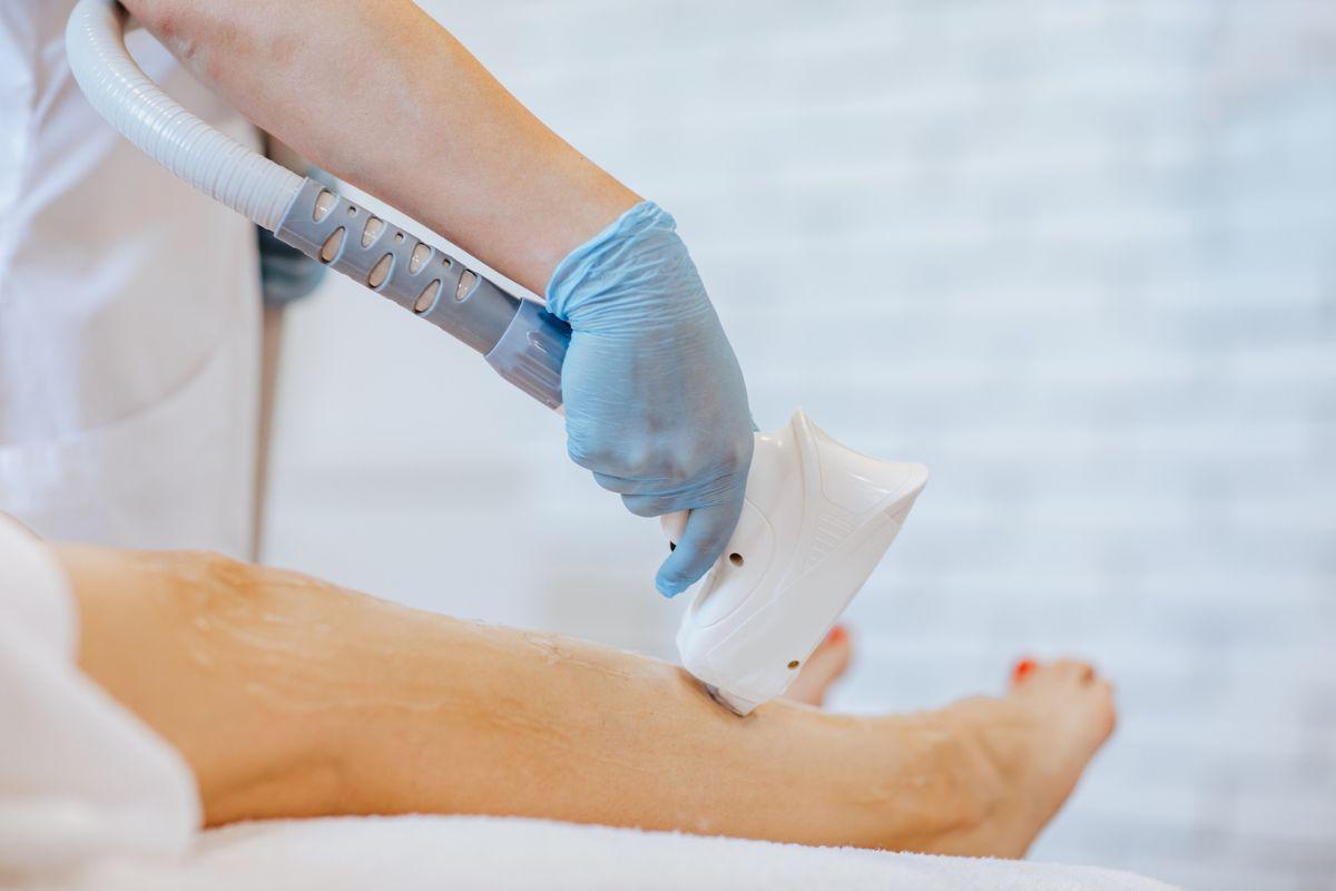 Mulher indenizada após queimaduras na virilha durante depilação a laser.