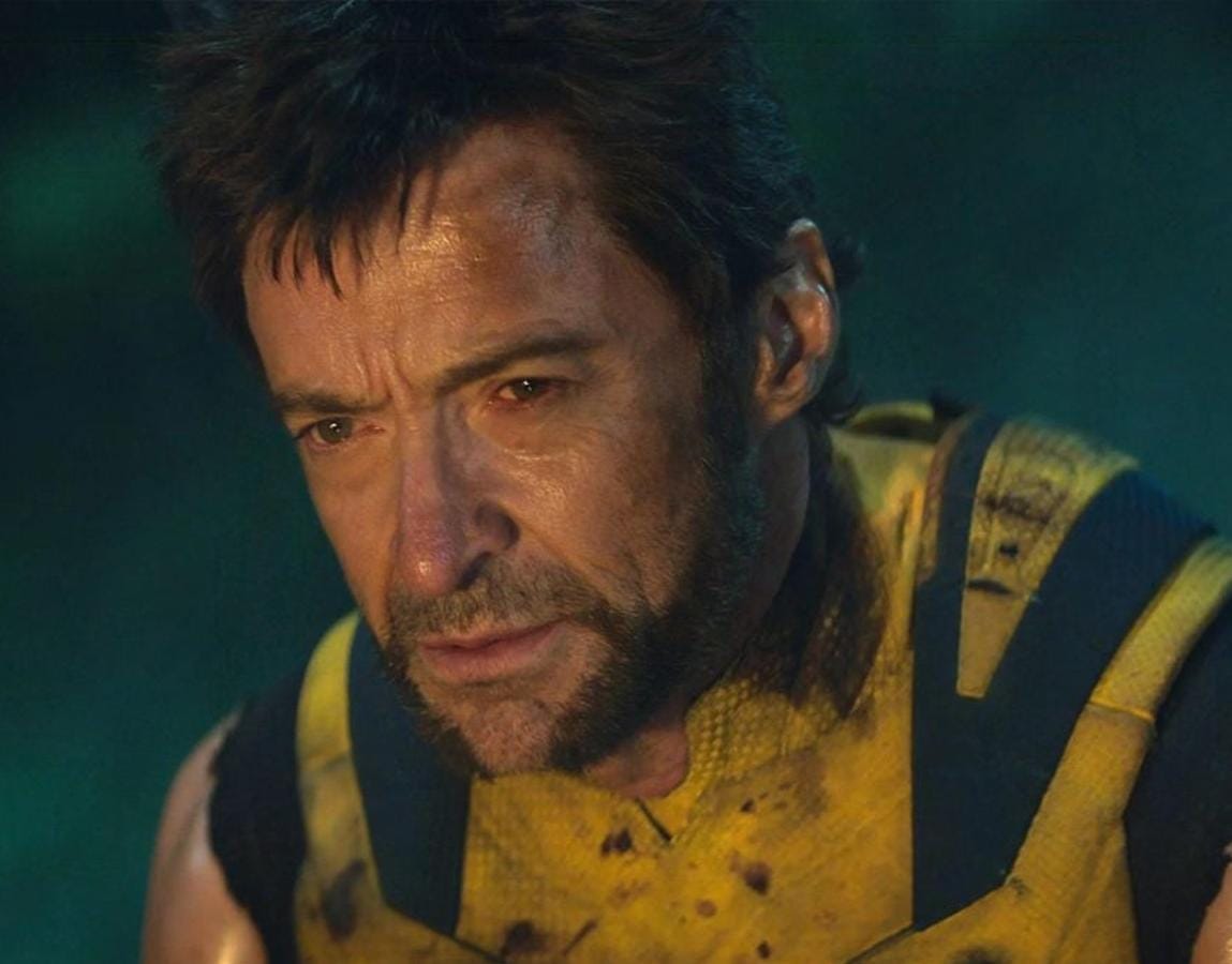 Revelado: Por que Hugh Jackman usou uniforme amarelo em 